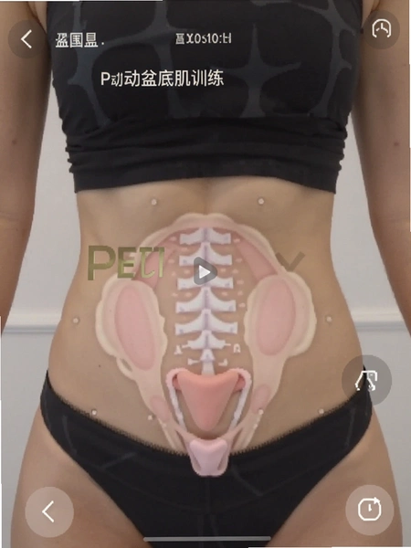 P�� ��׼�ѵ�������ͼ