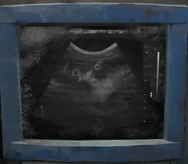 ֽ����8ǧ�����ٷ�����