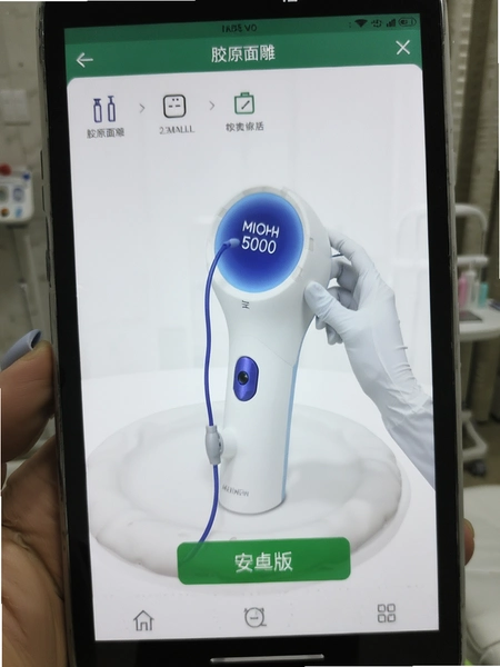 ��ԭ����ǰ�׿����������ǲ�������Ԥ��ͼ